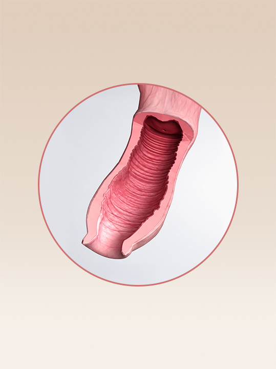 Result B&A - Intimate Rejuvenation - Vagina Filler_Before