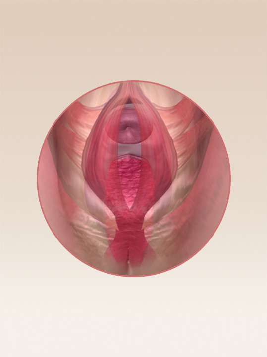Result B&A - Intimate Rejuvenation - Vagina Tightening_Before