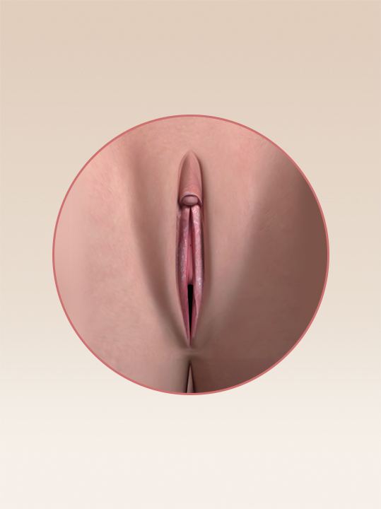 Result B&A - Intimate Rejuvenation - Vulvar Whitening_After.jpg